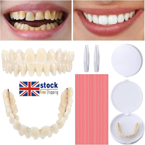 Denture repair kit for missing - kit,