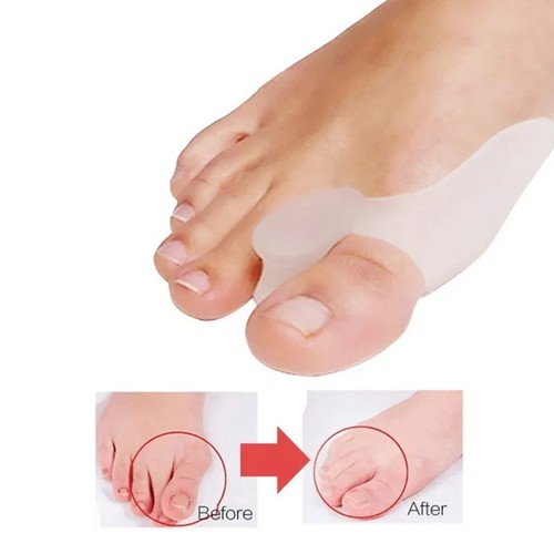 Silicone gel bunion - gel,