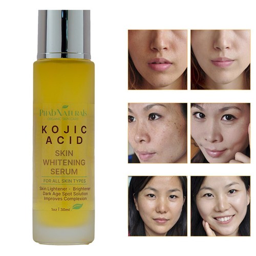 Kojic acid skin whitening - acid,