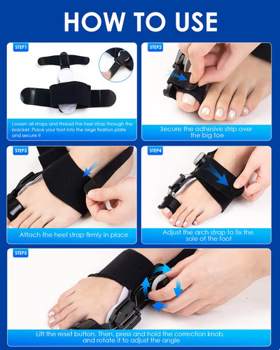 Adjustable bunion corrector - adjustable,