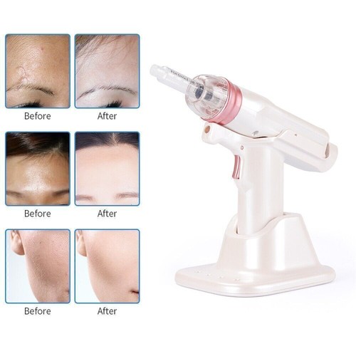 Hydro vacuum mesotherapy gun - hydro,