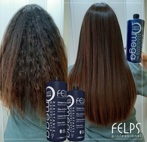 Felps omega zero nanoplastia - felps,