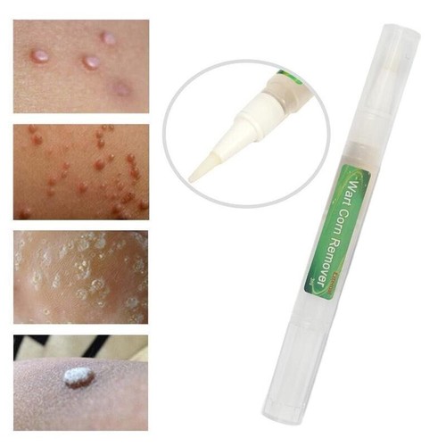 Skin tag removal - tag,