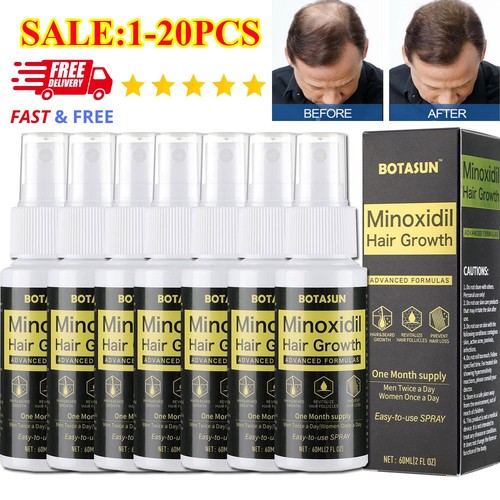 Minoxidil spray serum - 5%, hair