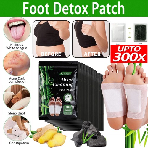 300pcs detox foot patches - 10~300pcs,