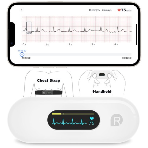 Checkme er2 mobile - ecg, ekg