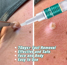 7 Days Wart Remover Pen Skin