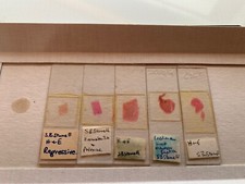Vintage Set of 25 Prepared Microscope Slides Various Path Subjects - S B Stunell