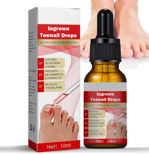 Ingrown toenail treatment - ingrown,