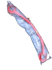 OMP MA/1681 Front Strut Brace