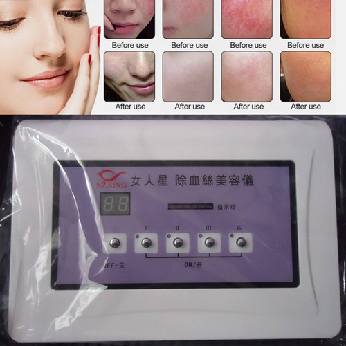 High frequency spider veins - spider,