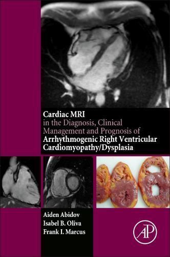 Cardiac mri diagnosis - cardiac, in
