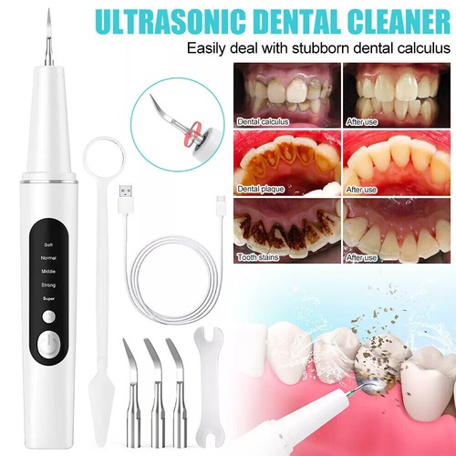 Ultrasonic tooth cleaner - ultrasonic,