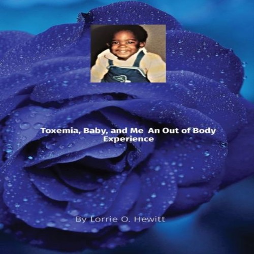 Toxemia baby and - baby,