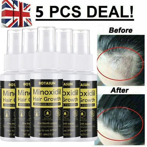 Minoxidil extra strength - minoxidil, 5%