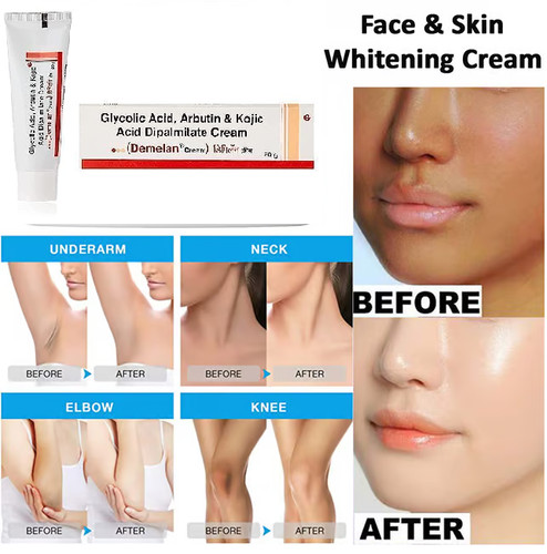 Kojic acid skin whitening - acid,