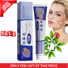STRONG SKIN TAG REMOVER Cream