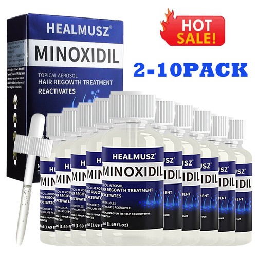 Minoxidil topical solution - minoxidil,