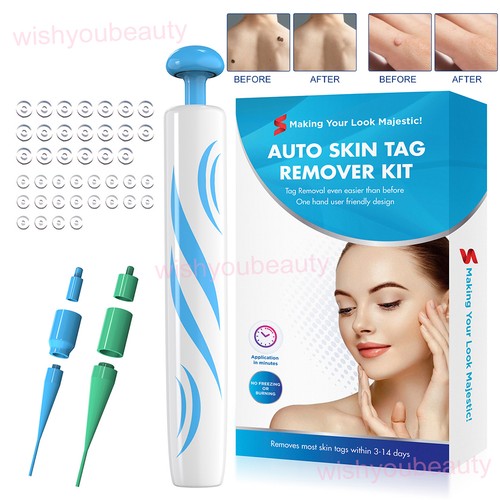 Painless skin tag - skin, remover