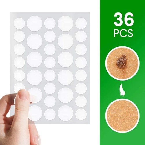 Skin tag removal patches - skin,