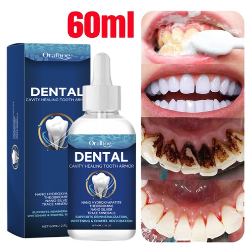 Dental cavity healing tooth - healing,