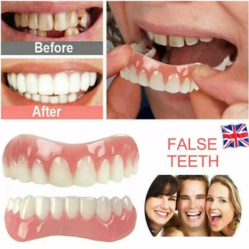 Snap false teeth upper - on,