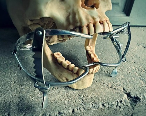 Medical mouth gag - medical, gag,