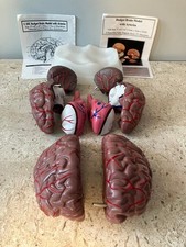 Budget Brain Model w/Arteries