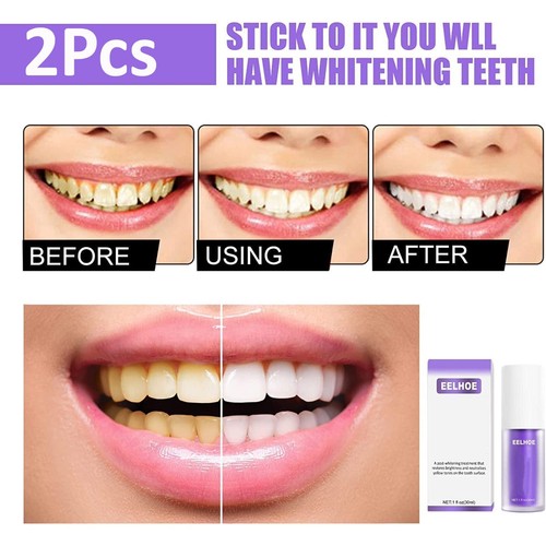 Purple teeth whitening - x,