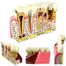 Dental Anatomical Diseased