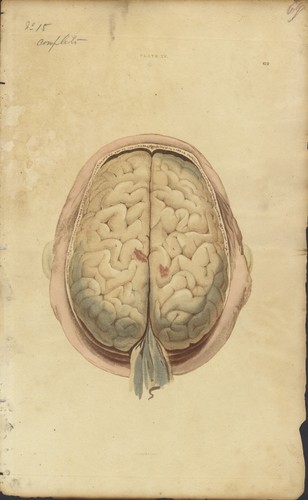 Brain from real - from, real,