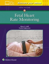 Fetal Heart Rate Monitoring by Alison Cahill PAPERBACK 9781975216184
