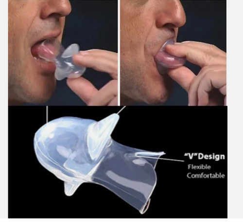 Anti snore mouthpiece - mouthpiece, tongue