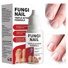 Fungi Nail Anti Fungal Liquid Formula Nail Repair Liquid Solution