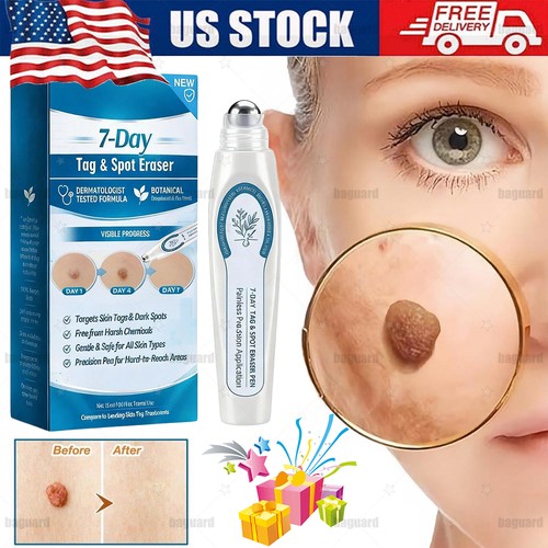 Tag spot eraser - tag, &spot