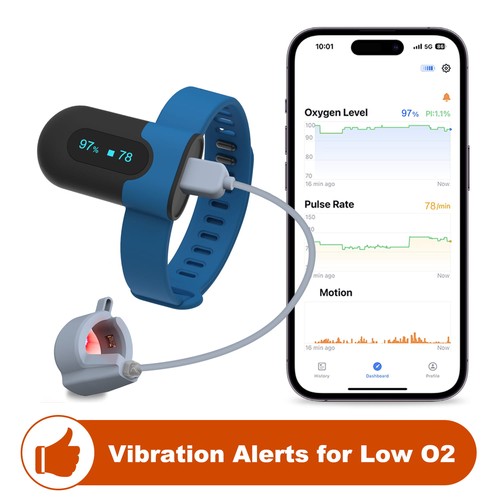 Wellue sleepu continuous - wellue, wrist