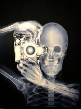 Vintage X-Ray Photo 372 Oddleys Strange & Bizarre