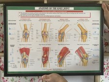 Vintage Medical Anatomical Art Print Framed Anatomy Of The Knee Joint Large