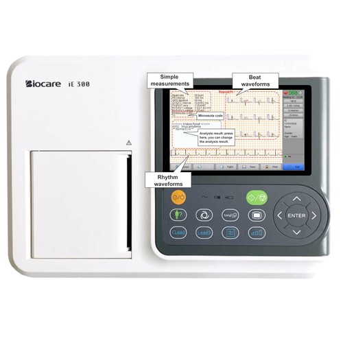 Portable lead ecg machine - 12-lead,