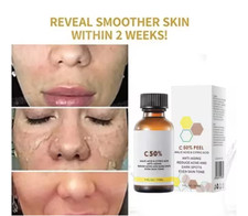 50% MALIC ACID & CITRIC ACID