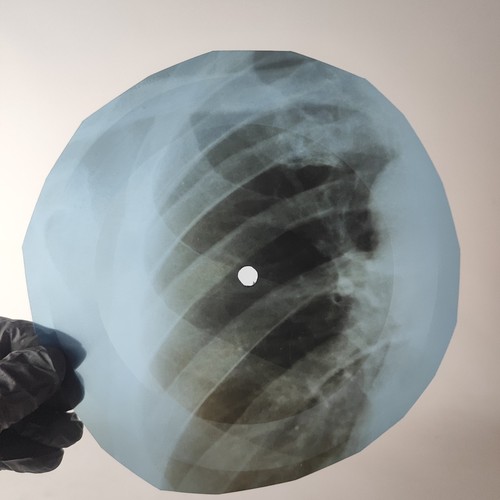 Elvis presley fever ray ussr - x-ray,