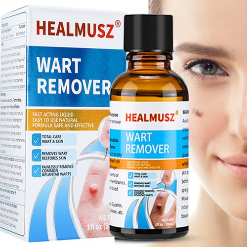 Wart remover fast - fast, and