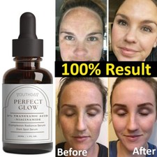 Tranexamic Topical Acid 5% Jumbo, Face & Skin Care with Kojic Acid 30ml