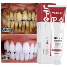 SP-6 Probiotic Toothpaste