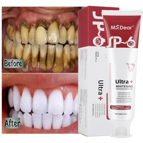 Probiotic toothpaste - sp-6,