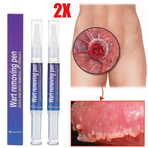 2pack hours wart remover - 12,