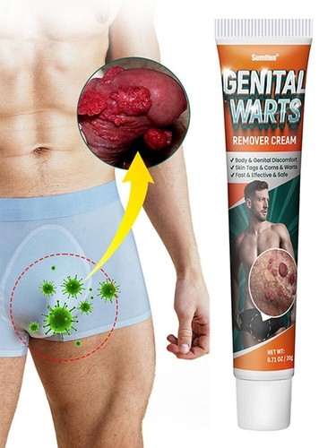 New private area - warts, removal