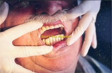 VINTAGE ORAL EXAM DENTAL INSPECTION GOLD CROWN FILLINGS PHOTO DENTAL 35MM SLIDE