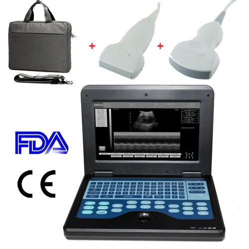 Portable ultrasound scanner - portable,