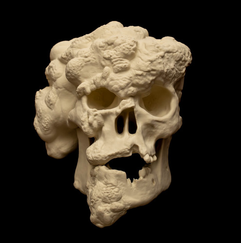 Joseph merrick skull replica - joseph,